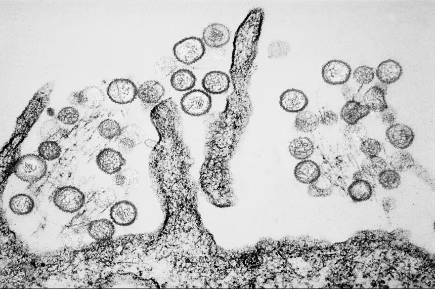 A transmission electron micrograph of the Sin Nombre Hantavirus.( BSIP/Universal Images Group/Getty Images/CNN)
